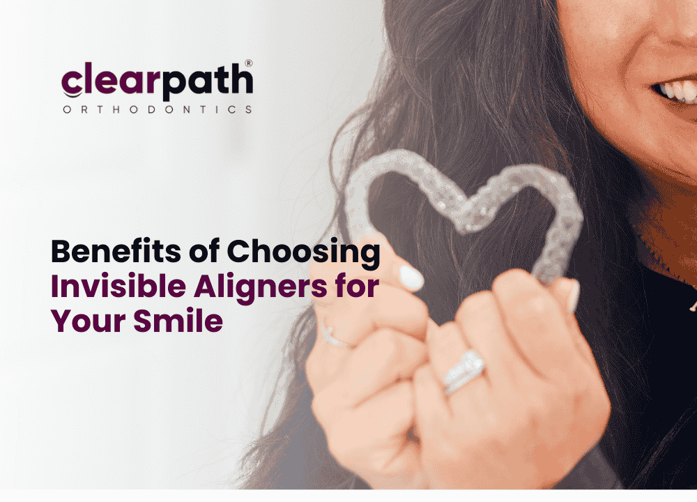 Aligners for Your Smile