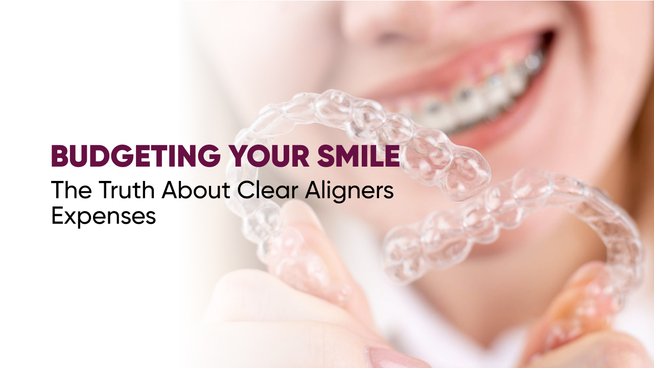 Budgeting Your Smile - Clear Aligner