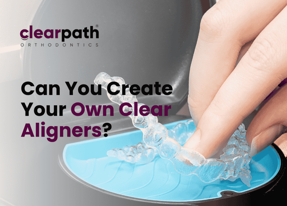 Can You Create Your Own Clear Aligners
