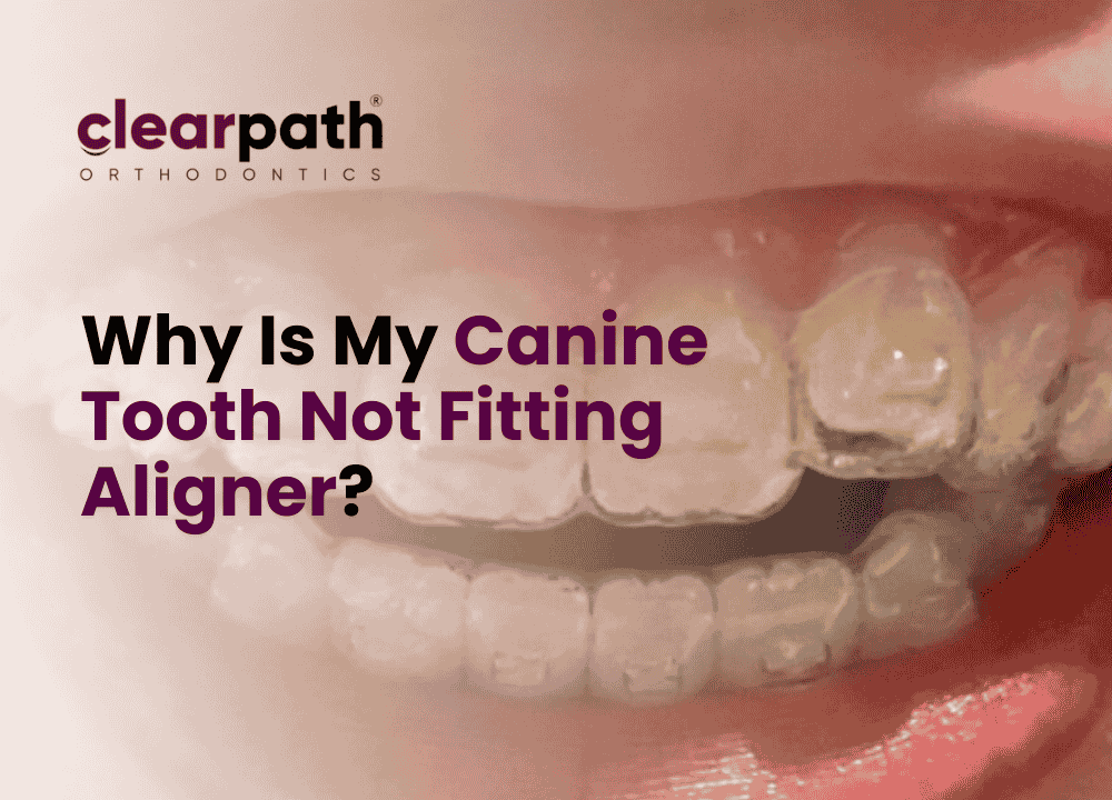 Canine Tooth Not Fitting Aligner