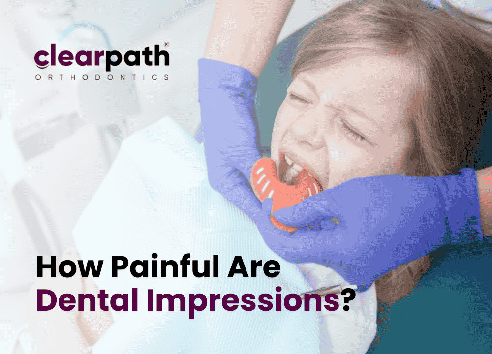 Dental Impressions