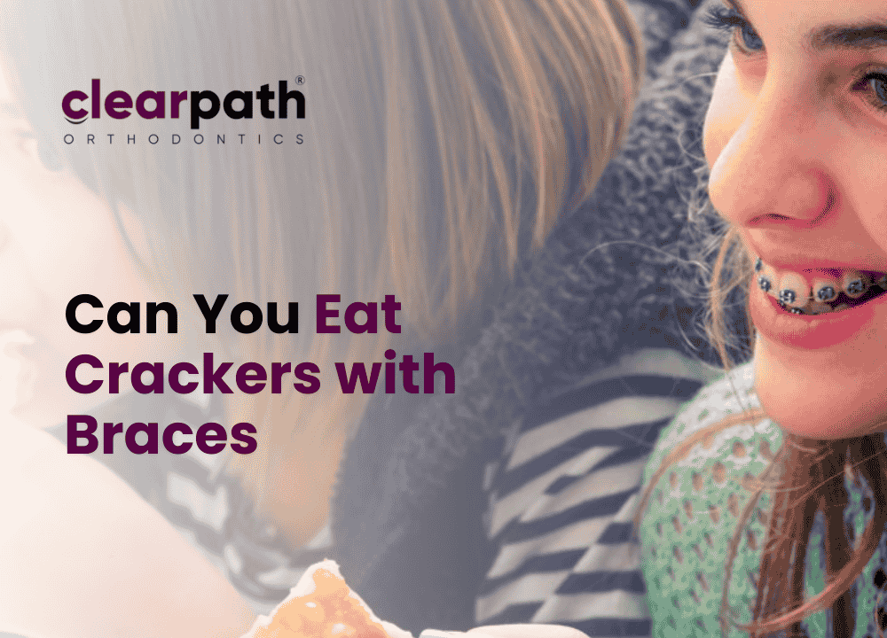 Eat Crackers with Braces