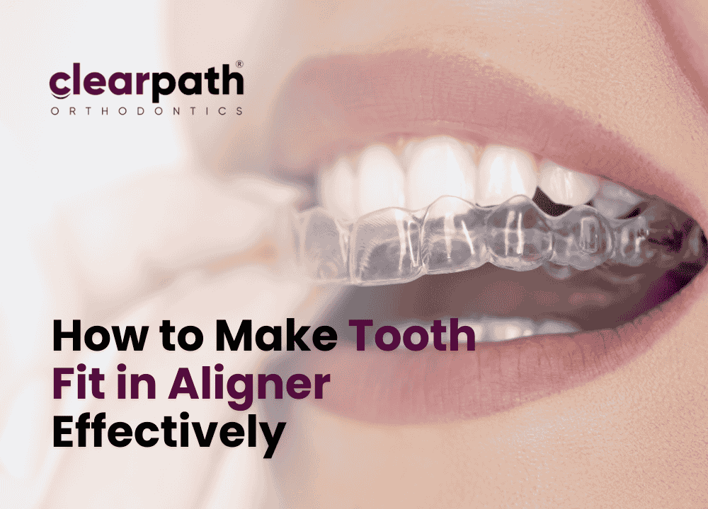 How to Make Tooth Fit in Aligner