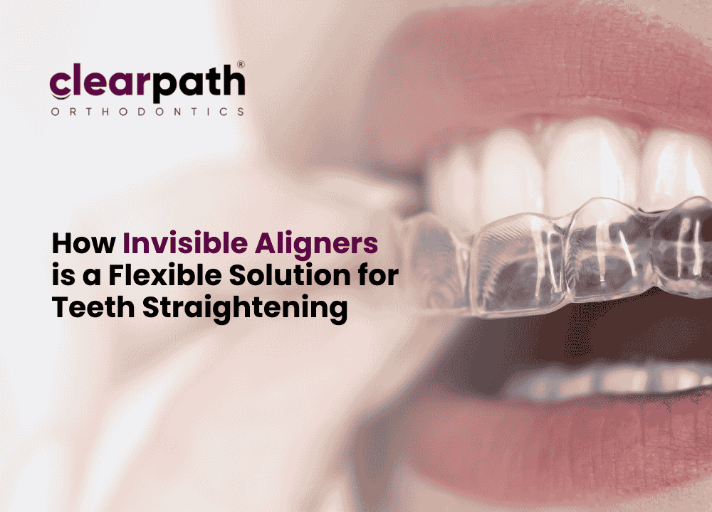 Invisible Aligners