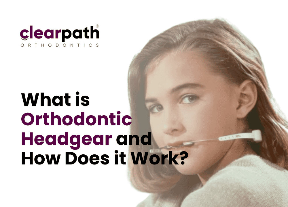 Orthodontic Headgear