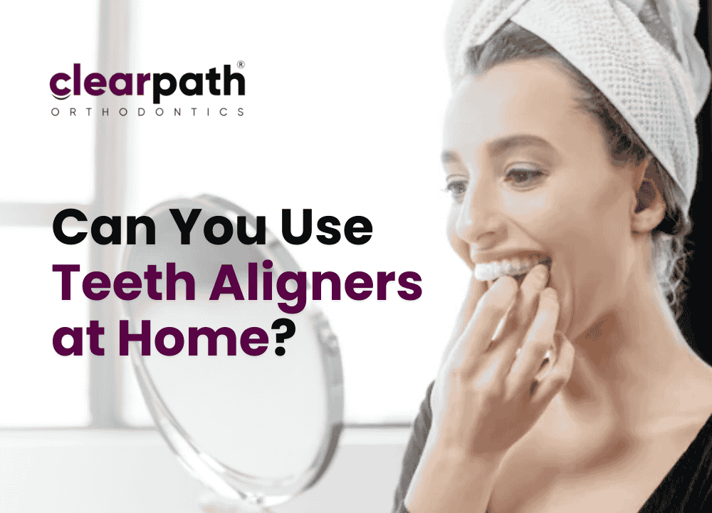 teeth aligners at home